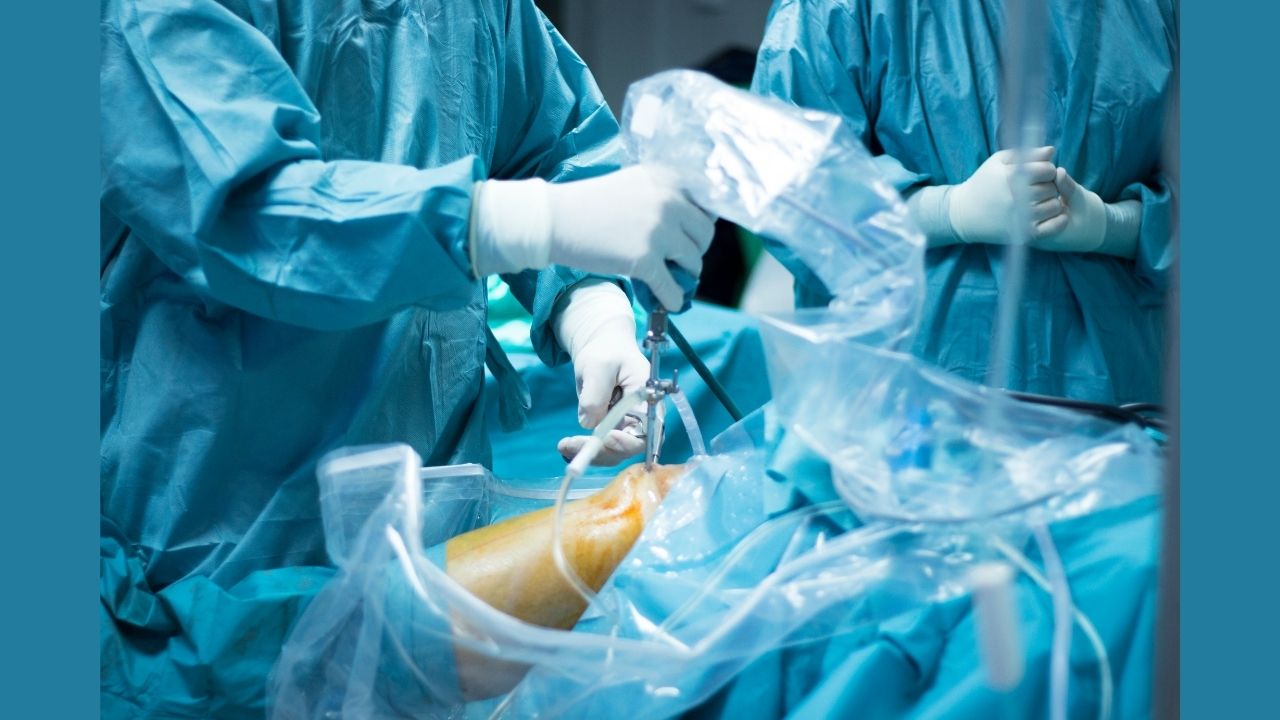 Arthroscopy 1