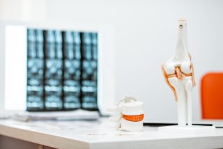 Knee replacement specialist in Lucknow demonstrating knee joint model with X-ray for diagnosis