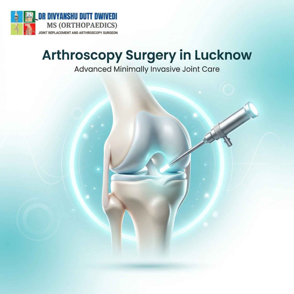 Arthroscopy-surgery-in-lucknow-1-1200x1200.jpg