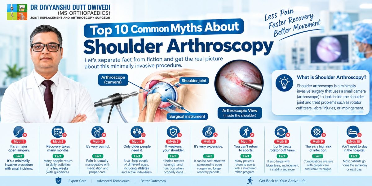 Top-10-Common-Myths-About-Shoulder-Arthroscopy-1200x600.jpg